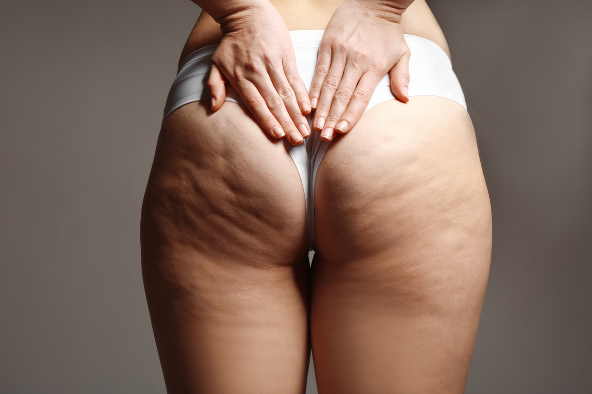 Woman's Hands on Buttocks 